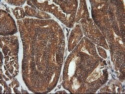 CDKN2B Mouse anti-Human, Clone: OTI8H4, lyophilized, TrueMAB 100 &mu;g;