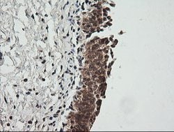 CDKN2B Mouse anti-Human, Clone: OTI8H4, lyophilized, TrueMAB 100 &mu;g;