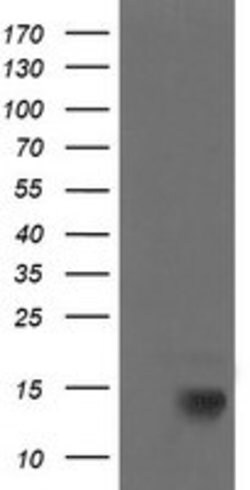 CDKN2B Mouse anti-Human, Clone: OTI7C4, lyophilized, TrueMAB 100 &mu;g;