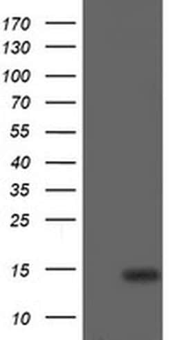CDKN2B Monoclonal Antibody (OTI3B6), TrueMAB , OriGene 100 &mu;L; Unconjugated:Antibodies,