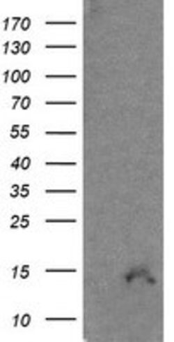 CDKN2B Mouse anti-Human, Clone: OTI8H4, lyophilized, TrueMAB 100 &mu;g;
