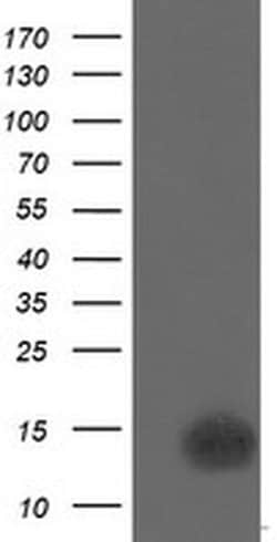 CDKN2B Monoclonal Antibody (OTI1H5), TrueMAB , OriGene 100 &mu;L; Unconjugated:Antibodies,