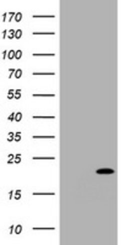 CDKN2C Mouse anti-Human, Clone: OTI6B3, lyophilized, TrueMAB 100 &mu;g;