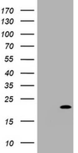 CDKN2C Monoclonal Antibody (OTI6B3), TrueMAB , OriGene 100 &mu;L; Unconjugated:Antibodies,