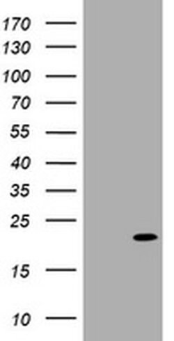 CDKN2C Monoclonal Antibody (OTI2D7), TrueMAB , OriGene 100 &mu;L; Unconjugated:Antibodies,