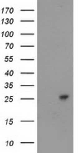 CDKN3 Mouse anti-Human, Clone: OTI1H5, lyophilized, TrueMAB 100 &mu;g;