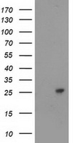 CDKN3 Monoclonal Antibody (OTI1H5), TrueMAB , OriGene 100 &mu;L; Unconjugated:Antibodies,