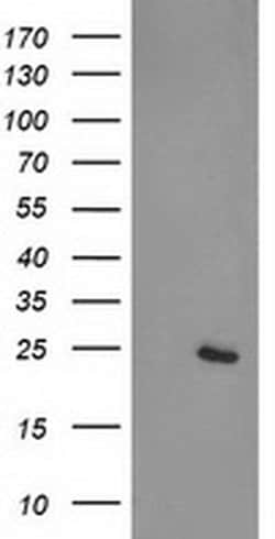CDKN3 Monoclonal Antibody (OTI2H10), TrueMAB , OriGene 100 &mu;L; Unconjugated:Antibodies,