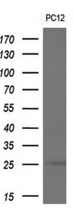 CDKN3 Monoclonal Antibody (OTI2H10), TrueMAB , OriGene 100 &mu;L; Unconjugated:Antibodies,