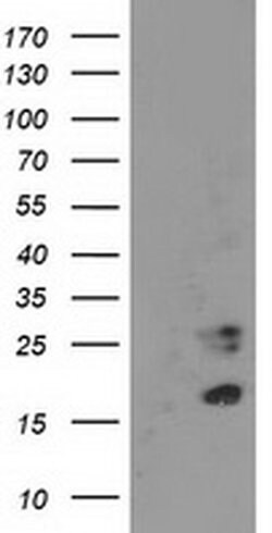 CDKN3 Mouse anti-Human, Clone: OTI2E11, liquid, TrueMAB 100 &mu;L; Unconjugated:Antibodies,