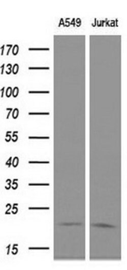 CDKN3 Mouse anti-Human, Clone: OTI2E11, lyophilized, TrueMAB 100 &mu;g;