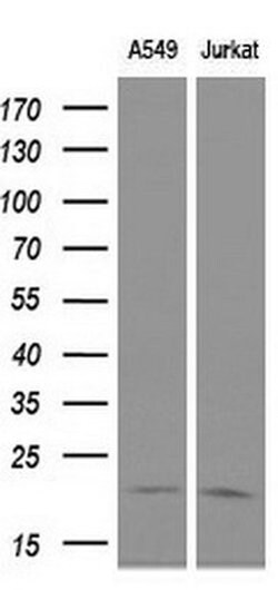 CDKN3 Mouse anti-Human, Clone: OTI2E11, liquid, TrueMAB 100 &mu;L; Unconjugated:Antibodies,