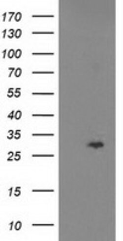 CDKN3 Mouse anti-Human, Clone: OTI2D11, lyophilized, TrueMAB 100 &mu;g;