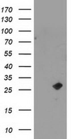 CDKN3 Monoclonal Antibody (OTI2H1), TrueMAB , OriGene 100 &mu;L; Unconjugated:Antibodies,