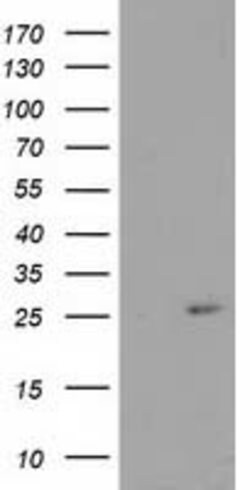 CDKN3 Mouse anti-Human, Clone: OTI5H1, lyophilized, TrueMAB 100 &mu;g;