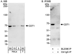 CDT1 Rabbit anti-Human, Polyclonal, Bethyl Laboratories 100 &mu;l; Unlabeled:Antibodies,