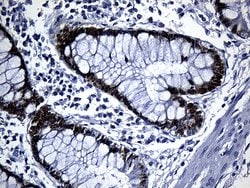 CDX1 Monoclonal Antibody (OTI2A5), TrueMAB , OriGene 100 &mu;L; Unconjugated:Antibodies,