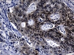 CDX1 Monoclonal Antibody (OTI2A5), TrueMAB , OriGene 100 &mu;L; Unconjugated:Antibodies,