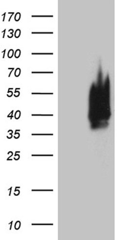 CDX1 Mouse anti-Human, Clone: OTI3A1, lyophilized, TrueMAB 100 &mu;g; Unconjugated:Antibodies,