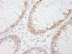 CDX2 Polyclonal Antibody, Bethyl Laboratories 10 &mu;L; Unconjugated:Antibodies,