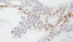 CDX2 Polyclonal Antibody, Bethyl Laboratories 10 &mu;L; Unconjugated:Antibodies,