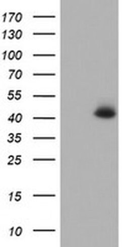 CDX2 Monoclonal Antibody (OTI5A1), TrueMAB , OriGene 100 &mu;L; Unconjugated:Antibodies,