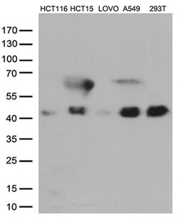 CDX2 Monoclonal Antibody (OTI5A1), TrueMAB , OriGene 100 &mu;L; Unconjugated:Antibodies,