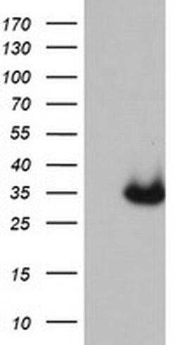 CDX2 Mouse anti-Human, Clone: OTI3B1, TrueMAB , Origene 30 &mu;L; Unconjugated:Anticuerpos