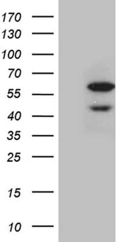 CDY2B Monoclonal Antibody (OTI5E1), TrueMAB , OriGene 100 &mu;L; Unconjugated:Antibodies,