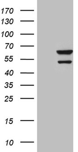 CDY2B Monoclonal Antibody (OTI4B8), TrueMAB , OriGene:Antibodies:Primary