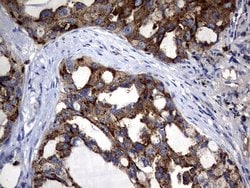 CEA (CEACAM5) Monoclonal Antibody (OTI2B12), TrueMAB , OriGene 100 &mu;L;