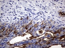 CEA (CEACAM5) Monoclonal Antibody (OTI2B12), TrueMAB , OriGene 100 &mu;L;
