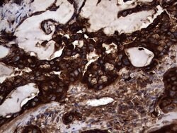 CEA (CEACAM5) Monoclonal Antibody (OTI3E10), TrueMAB , OriGene:Antibodies:Primary