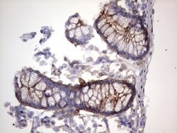 CEA (CEACAM5) Monoclonal Antibody (OTI3E10), TrueMAB , OriGene 100 &mu;L;