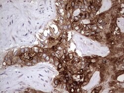 CEA (CEACAM5) Monoclonal Antibody (OTI3E10), TrueMAB , OriGene:Antibodies:Primary