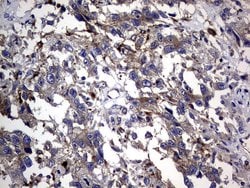 CEA (CEACAM5) Monoclonal Antibody (OTI1C2), TrueMAB , OriGene 100 &mu;L;