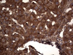 CEA (CEACAM5) Monoclonal Antibody (OTI1C2), TrueMAB , OriGene 100 &mu;L;
