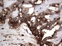 CEA (CEACAM5) Monoclonal Antibody (OTI1C2), TrueMAB , OriGene 100 &mu;L;