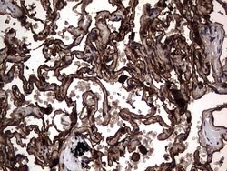 CEA (CEACAM5) Monoclonal Antibody (OTI1C2), TrueMAB , OriGene 100 &mu;L;