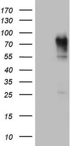 CEA (CEACAM5) Monoclonal Antibody (OTI2B12), TrueMAB , OriGene 100 &mu;L;