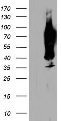 CEA (CEACAM5) Monoclonal Antibody (OTI9F9), TrueMAB , OriGene 100 &mu;L;