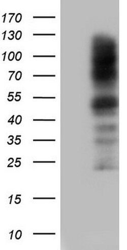 CEA (CEACAM5) Monoclonal Antibody (OTI1C2), TrueMAB , OriGene 100 &mu;L;