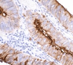 CEACAM1 Recombinant Rabbit Monoclonal Antibody (BLR032F), Bethyl Laboratories