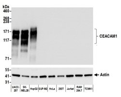 CEACAM1 Recombinant Rabbit Monoclonal Antibody (BLR032F), Bethyl Laboratories:Antibodies:Primary