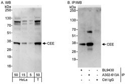 CEE Rabbit anti-Human, Polyclonal, Bethyl Laboratories 100 &mu;L; Unconjugated:Antibodies,