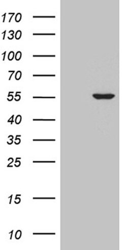 CELF6 Monoclonal Antibody (OTI2A9), TrueMAB , OriGene 100 &mu;L; Unconjugated:Antibodies,