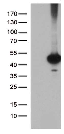 CELF6 Monoclonal Antibody (OTI5G3), TrueMAB , OriGene 100 &mu;L; Unconjugated:Antibodies,
