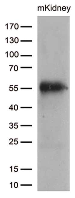 CELF6 Monoclonal Antibody (OTI5G3), TrueMAB , OriGene 100 &mu;L; Unconjugated:Antibodies,