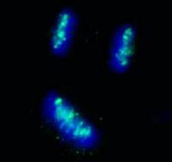 CENP-B Polyclonal Antibody, Bethyl Laboratories:Antibodies:Primary Antibodies