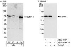 CENP-T Rabbit anti-Human, Polyclonal, Bethyl Laboratories 100 &mu;L | Buy Online | Bethyl Laboratories, Inc | Fisher Scientific